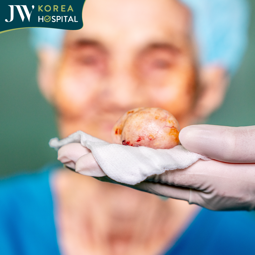 khối bướu quỷ của cụ bà đã được cắt bỏ thành công