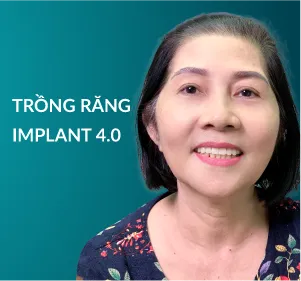 Trồng răng Implant 4.0