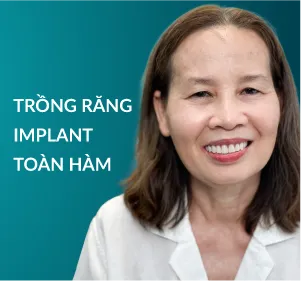 Trồng răng Implant toàn hàm