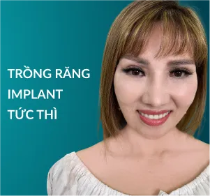 Trồng răng Implant tức thì