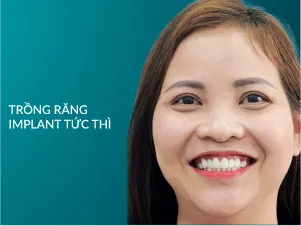 Trồng răng Implant Tức Thì