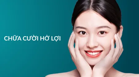 Chữa cười hở lợi