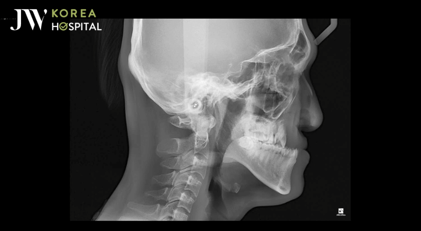 Chụp hình X Quang trước khi phẫu thuật