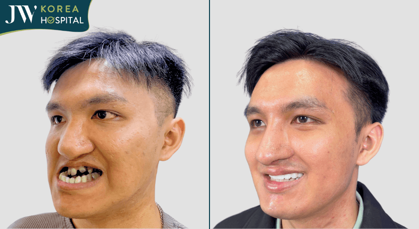 phẫu thuật Hàm, Niềng Răng, Bọc răng sứ, Nâng mũi tại Bệnh viện JW