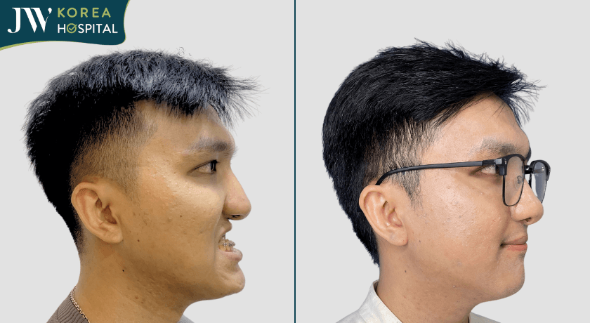 Phẫu thuật hàm tại bệnh viện JW