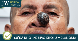 sư bà Khơ-me mắc khối u Melanoma