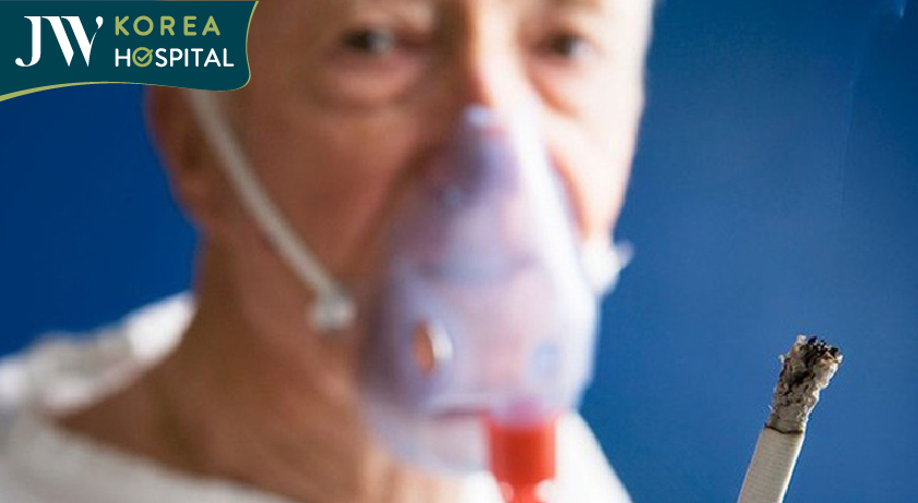 Khói thuốc lá có thể tăng nguy cơ mắc bệnh COPD
