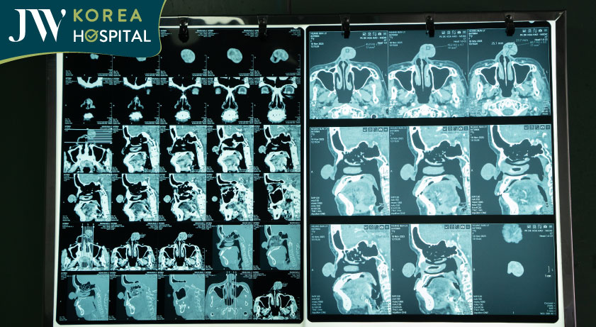 Hình ảnh chụp MRI của sư bà 