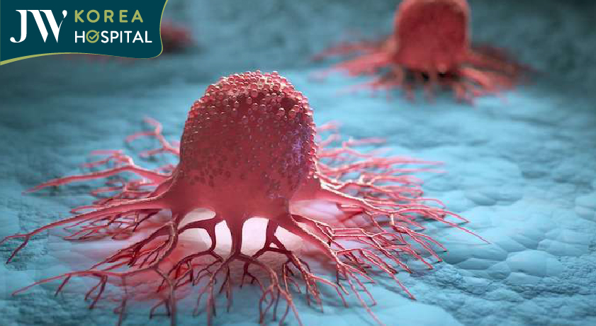 Khối u ác tính Melanoma nếu không được điều trị kịp thời có thể gây nguy hiểm tới tính mạng