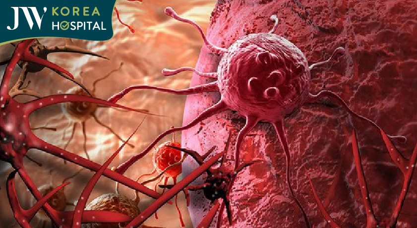 Khối u ác tính Melanoma gây nguy hiểm tới tính mạng người bệnh