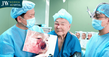 3 giờ căng não phẫu thuật cắt khối u máu đã lở loét cho cụ bà 93 tuổi bị suy tim nặng