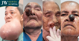 bác sĩ Tú Dung phẫu thuật U bướu miễn phí cho bệnh nhân nghèo