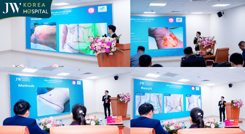 BS Nguyễn Phan Tín báo cáo tạo hình thành bụng trong hội nghị HSAPS 2025