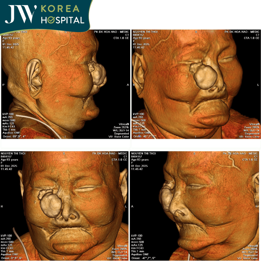 kết quả chụp hình trước khi phẫu thuật