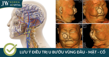 Điều trị u bướu vùng đầu – mặt – cổ cần lưu ý những gì?