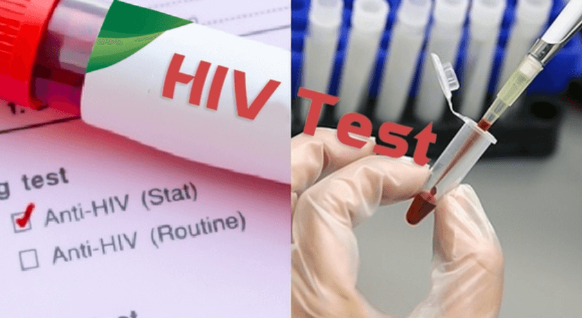nên khám định kỳ để nhận biết sớm HIV/AIDS