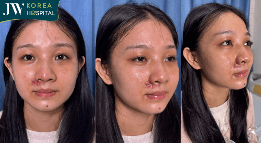 Sau 10 ngày điều trị tại Bệnh viện JW