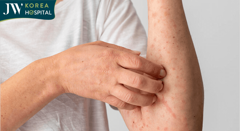 Triệu chứng của lây nhiễm HIV/