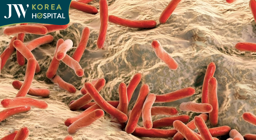 Bệnh phong là 1 bệnh truyền nhiễm do vi khuan Mycobacterium leprae gây ra