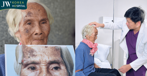 Cụ bà thay đổi gương mặt sau 7 ngày được bác sĩ Tú Dung cắt u miễn phí