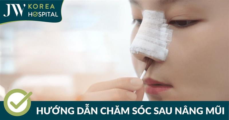Hướng dẫn chăm sóc sau nâng mũi S Line 3D tại Bệnh viện JW