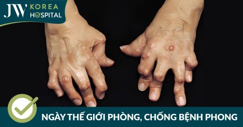 Hưởng ứng Ngày Thế giới phòng, chống bệnh phong 25/01/2026