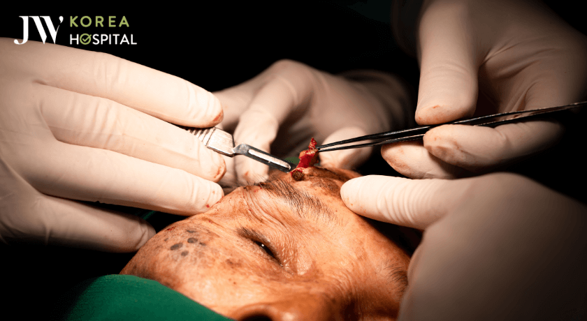 quá trình cắt khối U cho cụ bà 90 tuổi