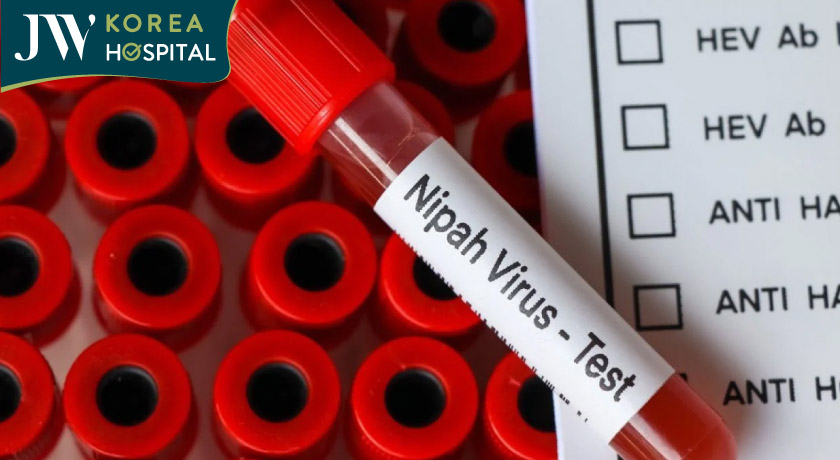 Cần xét nghiệm sớm để phòng ngừa dịch bệnh và có biện pháp điều trị hỗ trợ kịp thời