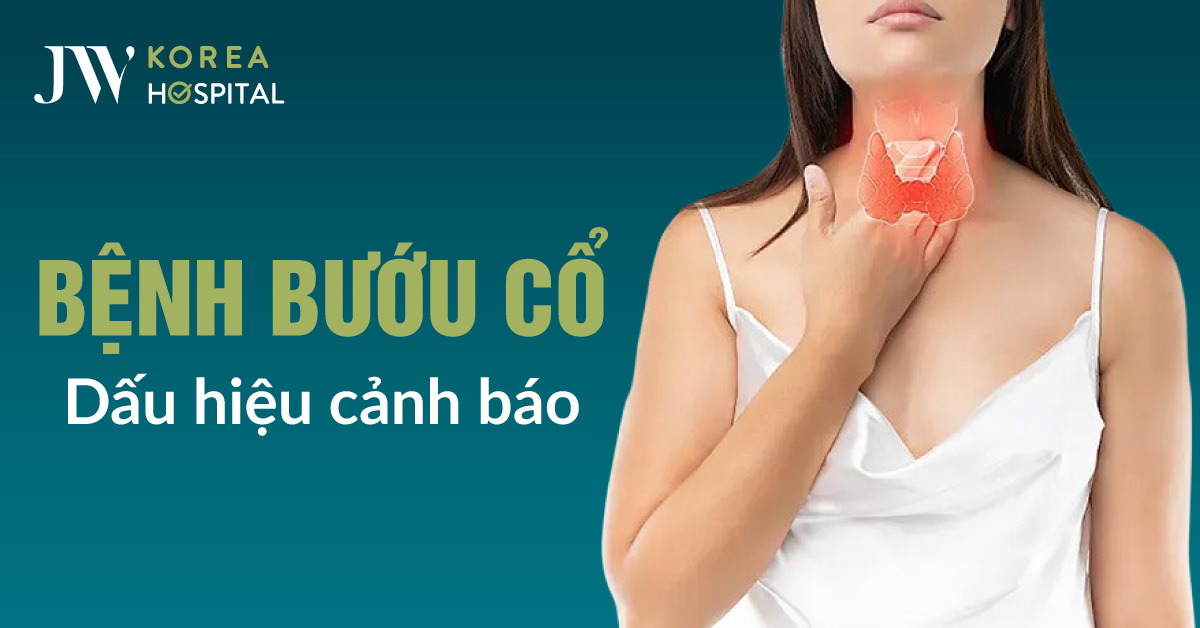 Những Dấu Hiệu Nhận Biết Bướu Cổ Sớm – Bệnh Viện JW Hàn Quốc