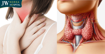 Bướu cổ: Nguyên nhân, dấu hiệu và cách điều trị chuẩn Y khoa tại JW