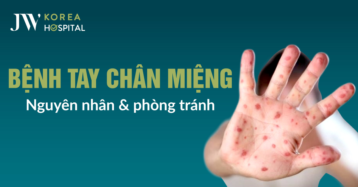 Bệnh Viện JW Cảnh Báo Nguy Cơ & Phòng Bệnh Tay Chân Miệng