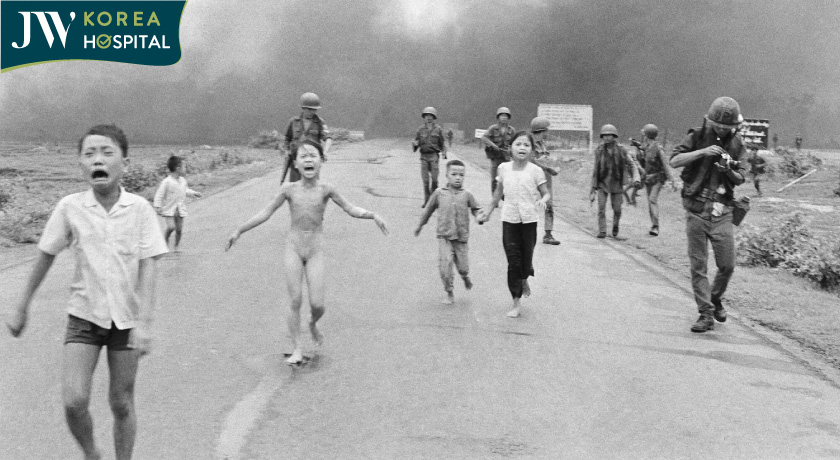 Bức anh em bé Napalm nổi tiếng toàn cầu 