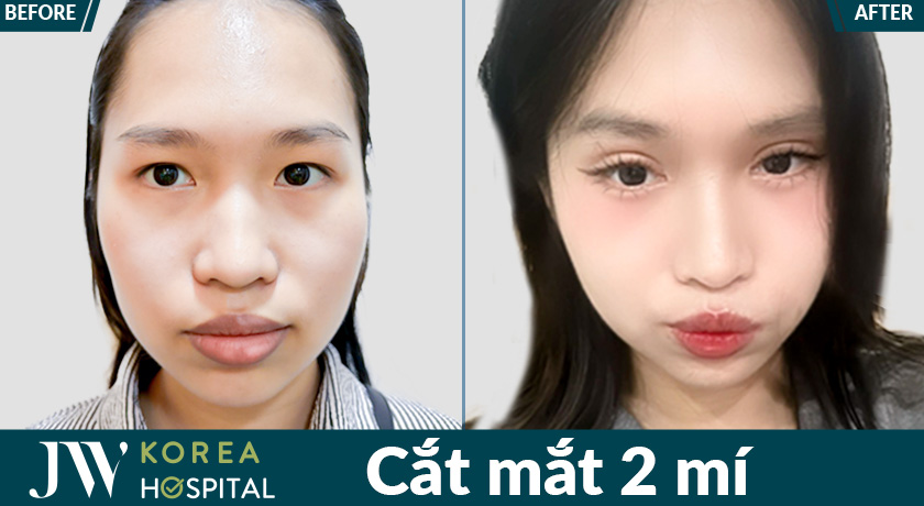Mắt hai mí tự tin & cuốn hút