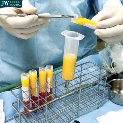 cấy mỡ sẹo bỏng để làm mềm mô