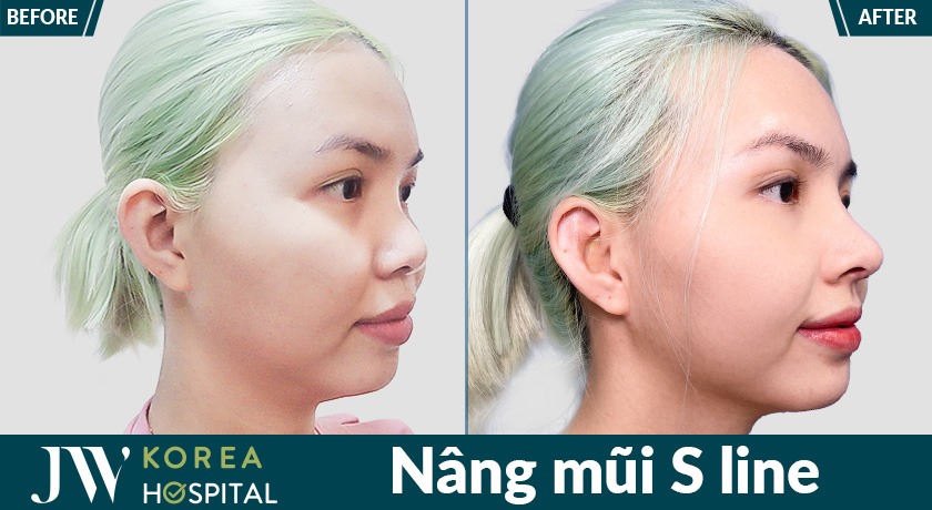 Dáng mũi sline thanh tú chuẩn vibe Hàn Quốc