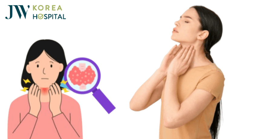 khi nào cần đi khám bướu cổ