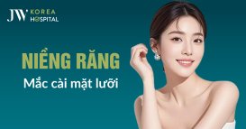Niềng răng mắc cài mặt lưỡi