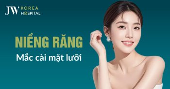 Niềng Răng Mắc Cài Mặt Lưỡi (Mặt Trong) Tại Bệnh Viện JW Có Gì?
