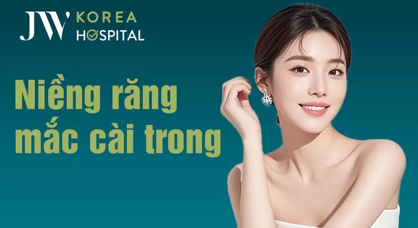 Niềng Răng Mắc Cài Mặt Lưỡi (Mặt Trong) Tại Bệnh Viện JW Có Gì?