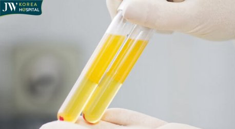 prp huyết tương giàu tiểu cầu 2