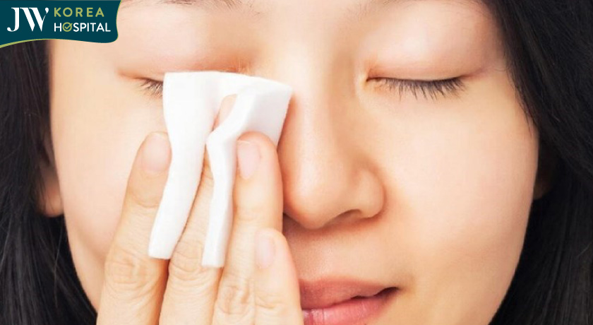 Vệ sinh kĩ lưỡng vừng mắt sau khi phẫu thuật