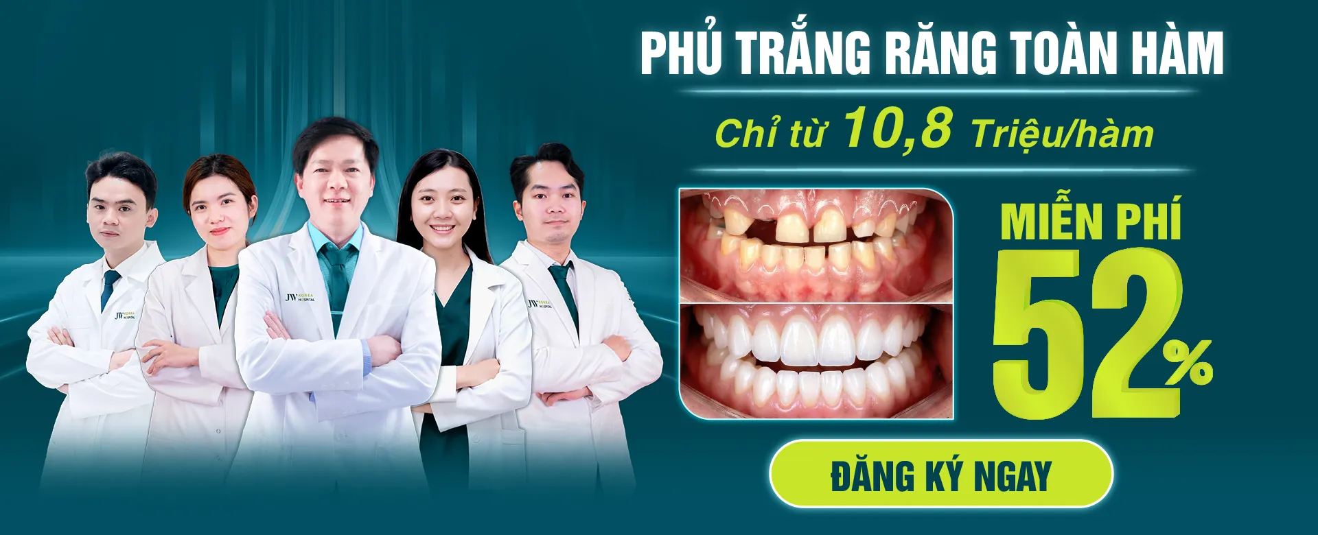 Phủ trắng răng toàn hàm chỉ từ 10,8 triệu
