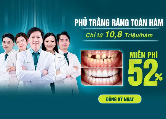 Phủ trắng răng 2026