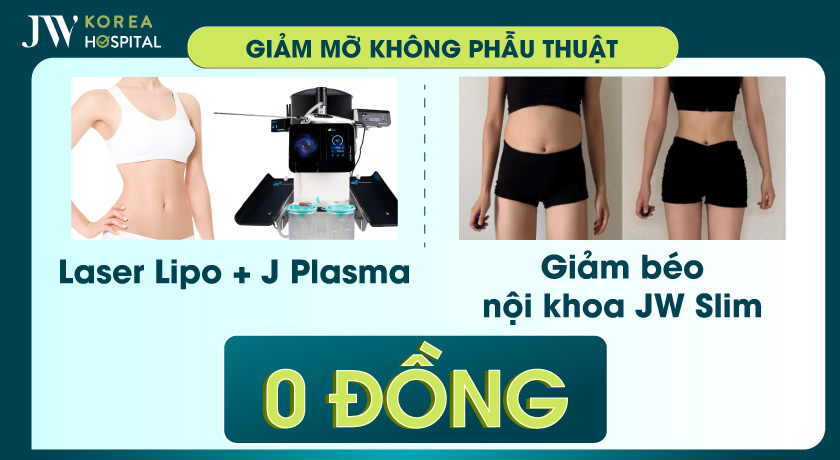 Bệnh viện JW tặng 5 suất 0 đồng hút mỡ không phẫu thuật với công nghệ laser lipo và J Plasma
