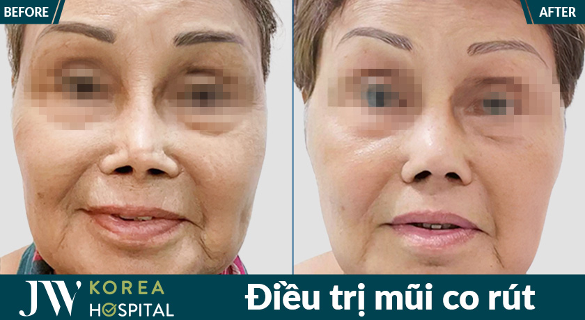 Nhiều khách hàng tìm lại sự tự tin nhờ được điều trị kịp thời tại Bệnh viện JW