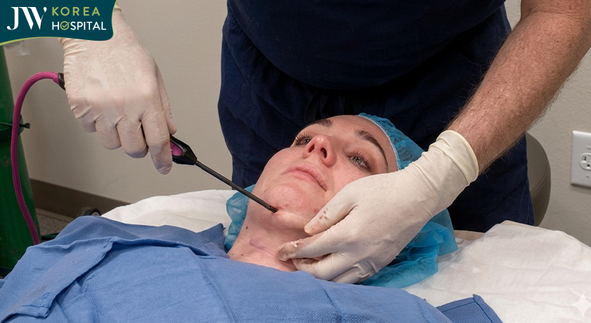 Lợi ích khi thực hiện kĩ thuật J plasma