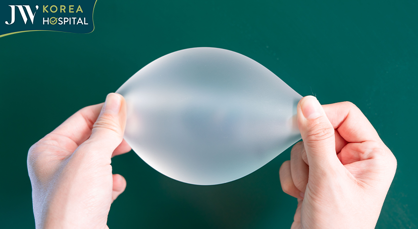 Túi ngực Motiva Ergonomix 2 - bảo tồn mô vú