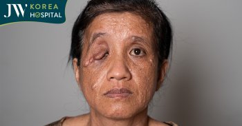 50 năm mắc bệnh đa u sợi thần kinh, người phụ nữ tìm lại được ánh sáng tại JW