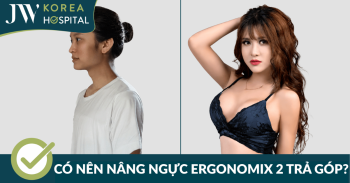 Có nên nâng ngực túi Ergonomix 2 trả góp không? Bệnh viện JW giải đáp