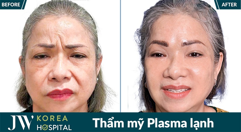 Plasma lạnh tại Bệnh viện JW giúp hỗ trợ kháng khuẩn sau phẫu thuật